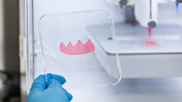 NUS Researchers Combine 3D Bioprinting with AI to Personalize Gum Tissue Grafts